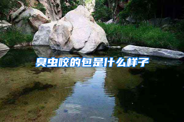 臭蟲咬的包是什么樣子